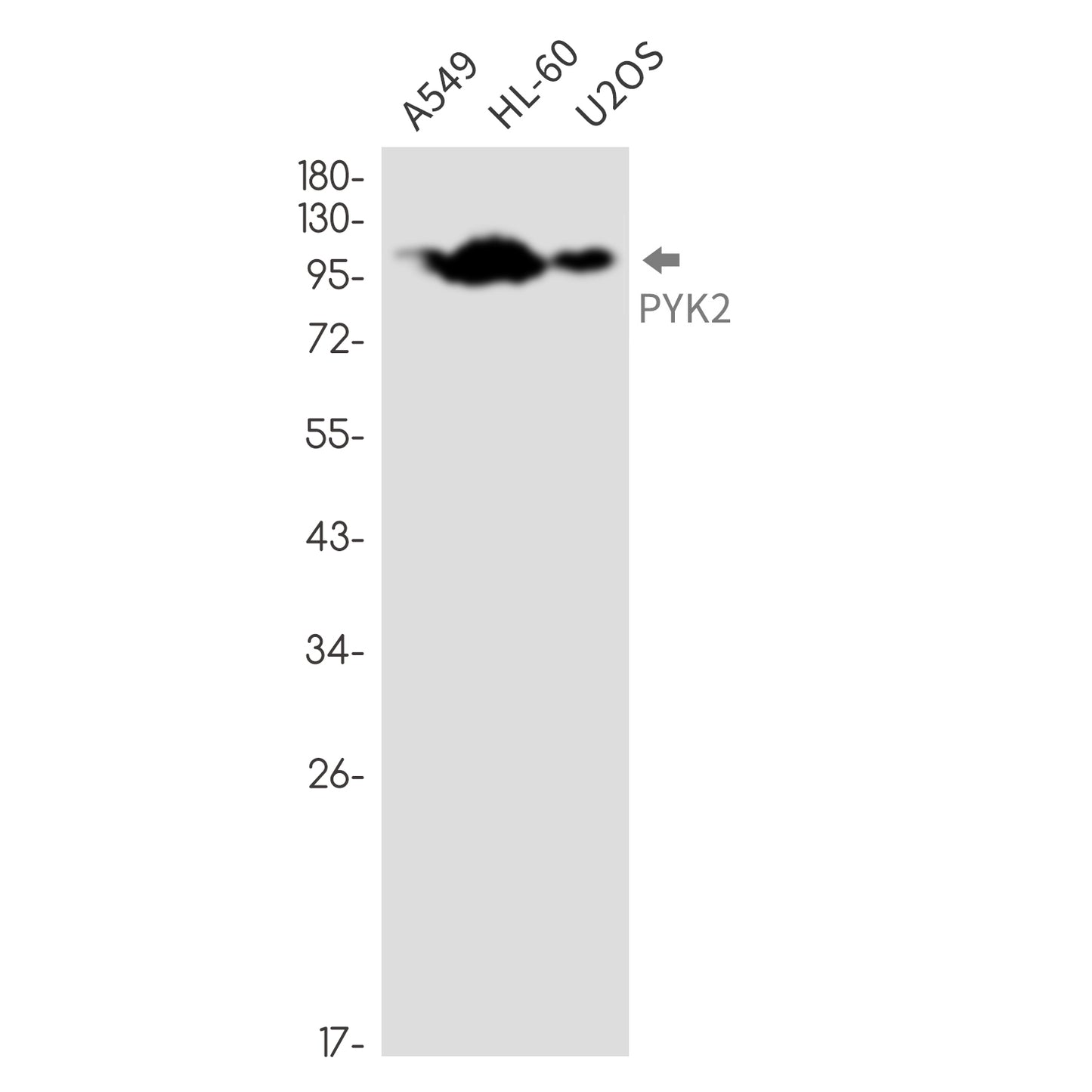 PYK2 Rabbit Monoclonal Antibody