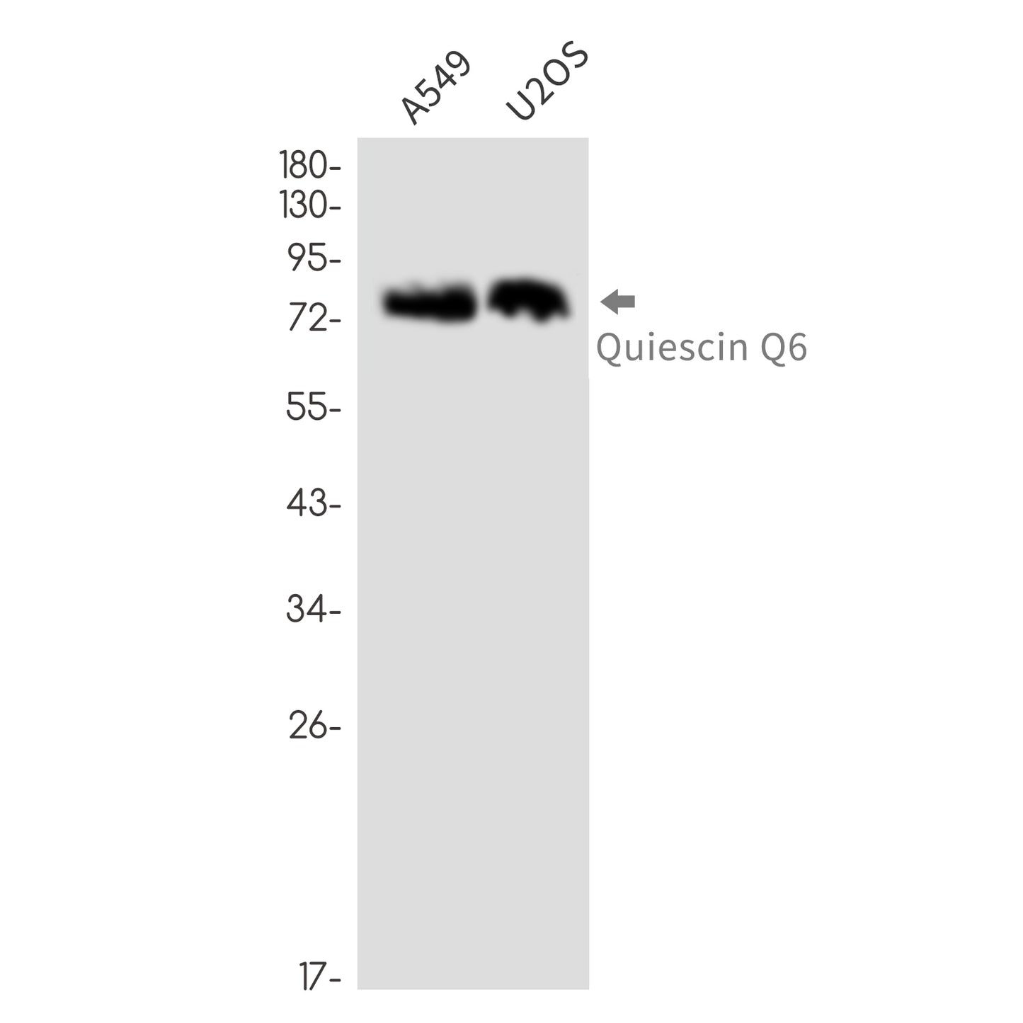 QSOX1 Rabbit Monoclonal Antibody