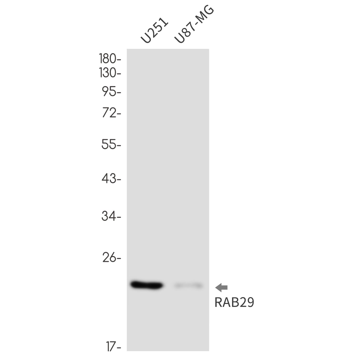 Rab29 Rabbit Monoclonal Antibody