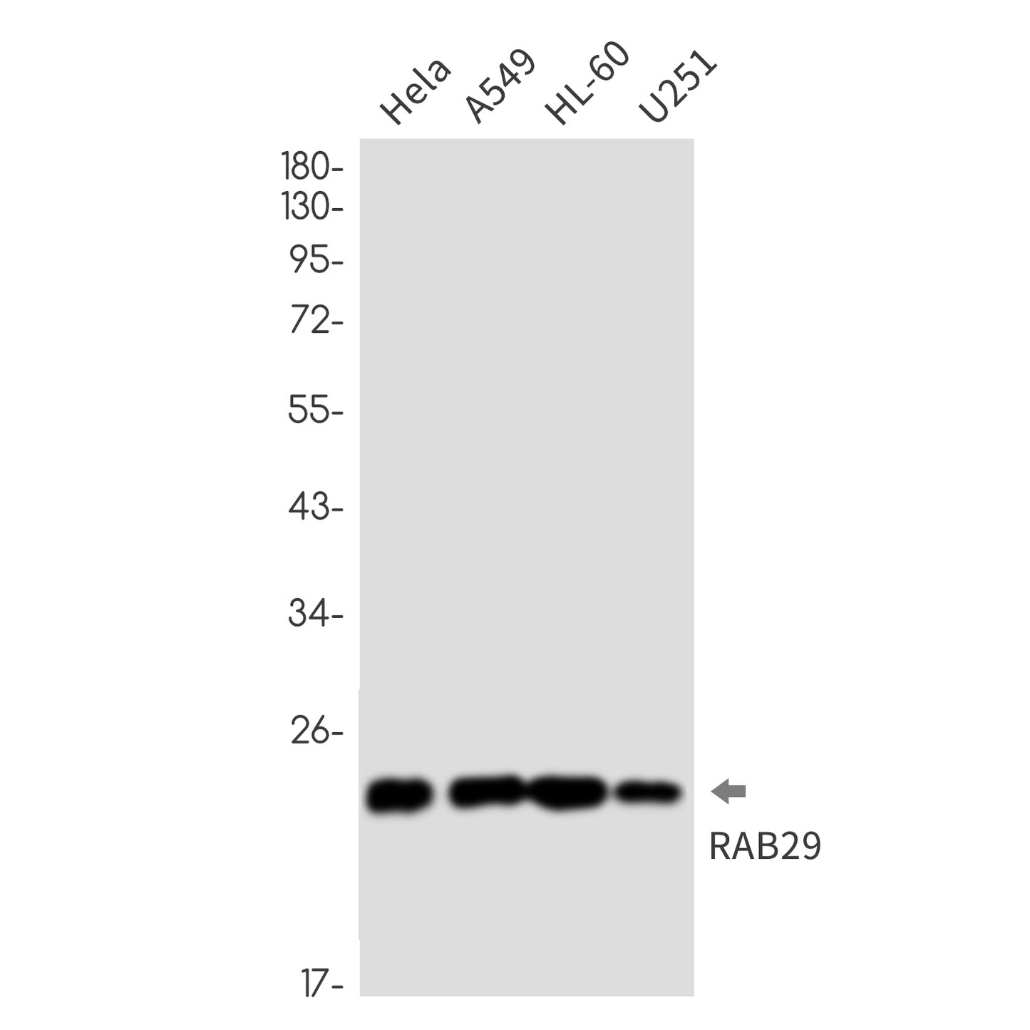 Rab29 Rabbit Monoclonal Antibody