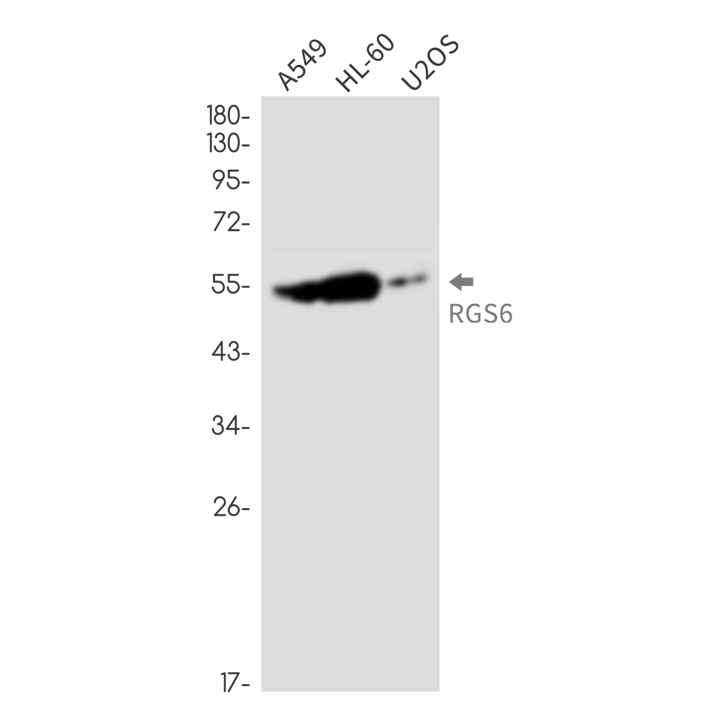 RGS6 Rabbit Monoclonal Antibody