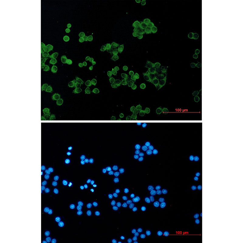 RhoGDI Rabbit Monoclonal Antibody