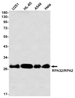 RPA32 Rabbit Monoclonal Antibody