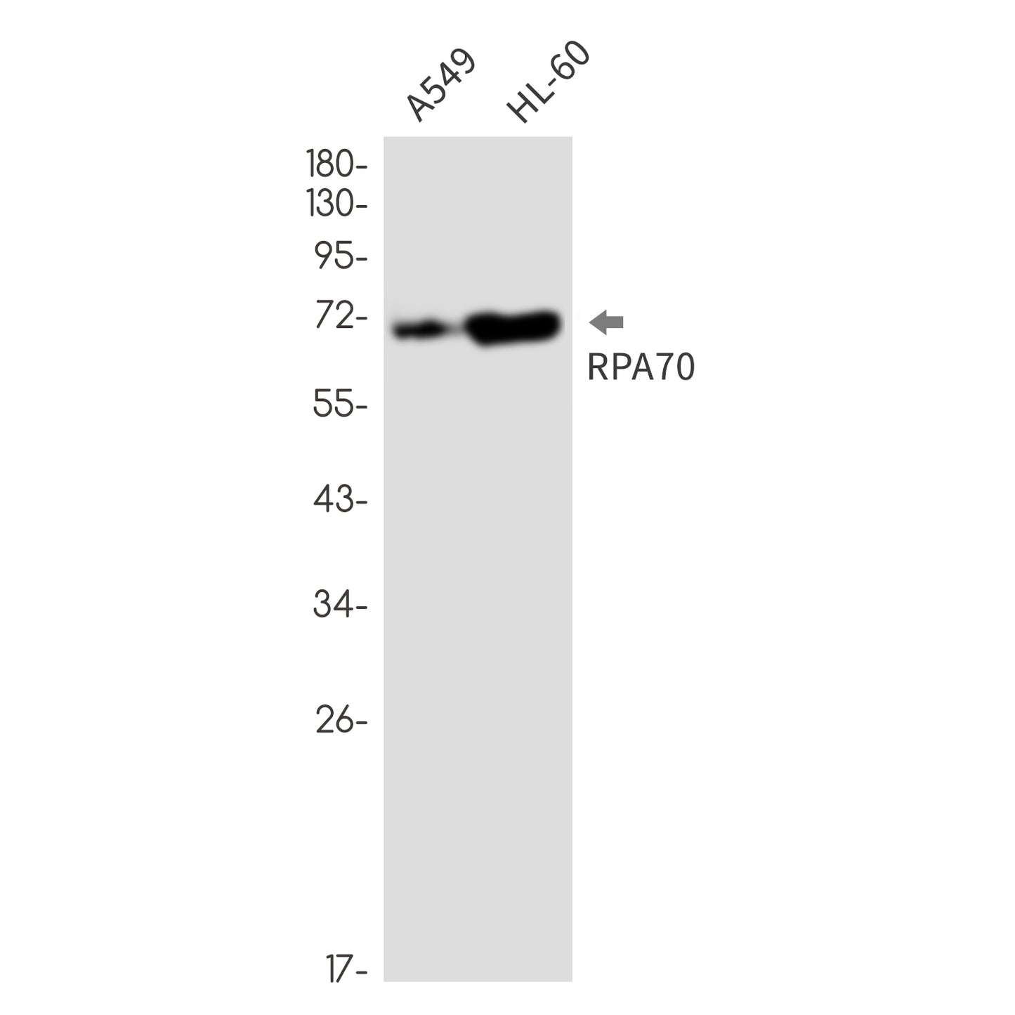 RPA70 Rabbit Monoclonal Antibody