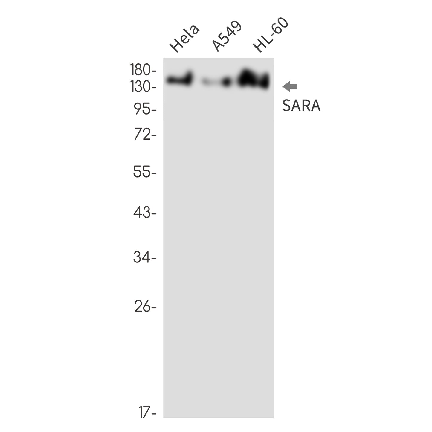 SARA Rabbit Monoclonal Antibody