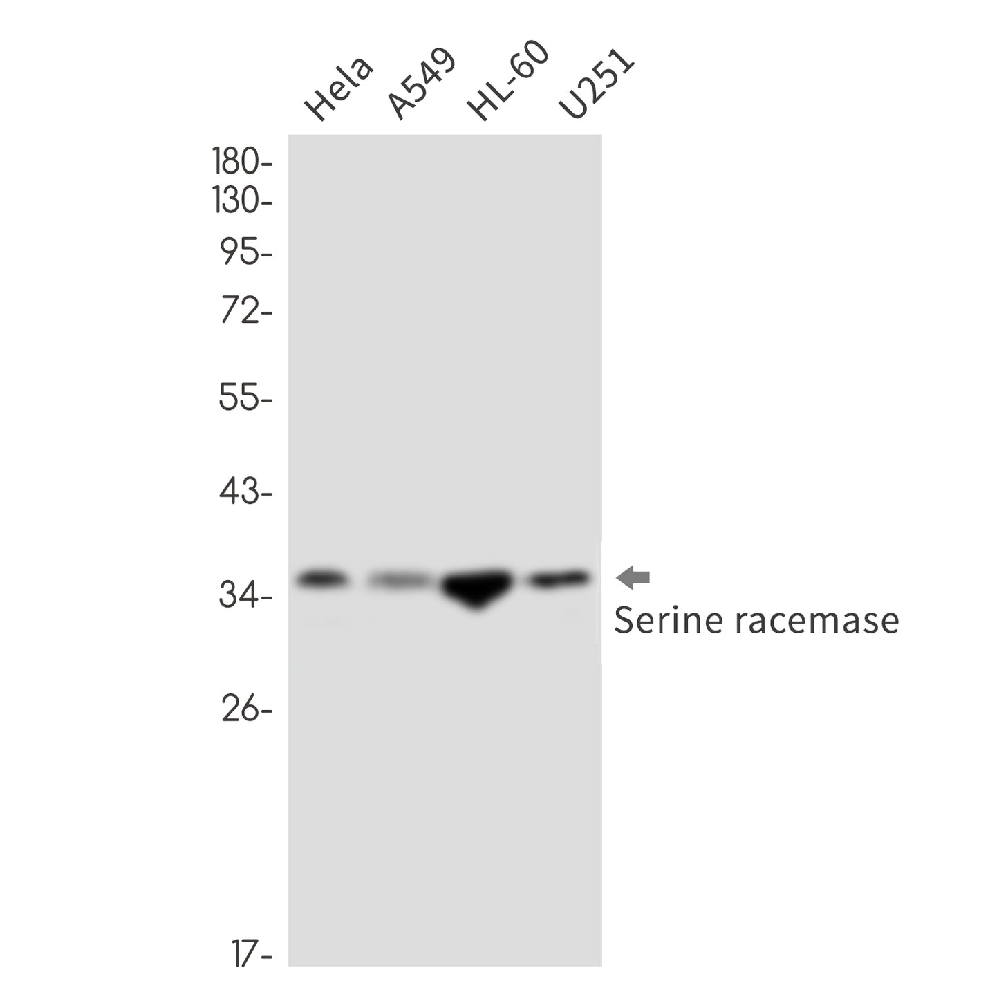 Serine Racemase Rabbit Monoclonal Antibody