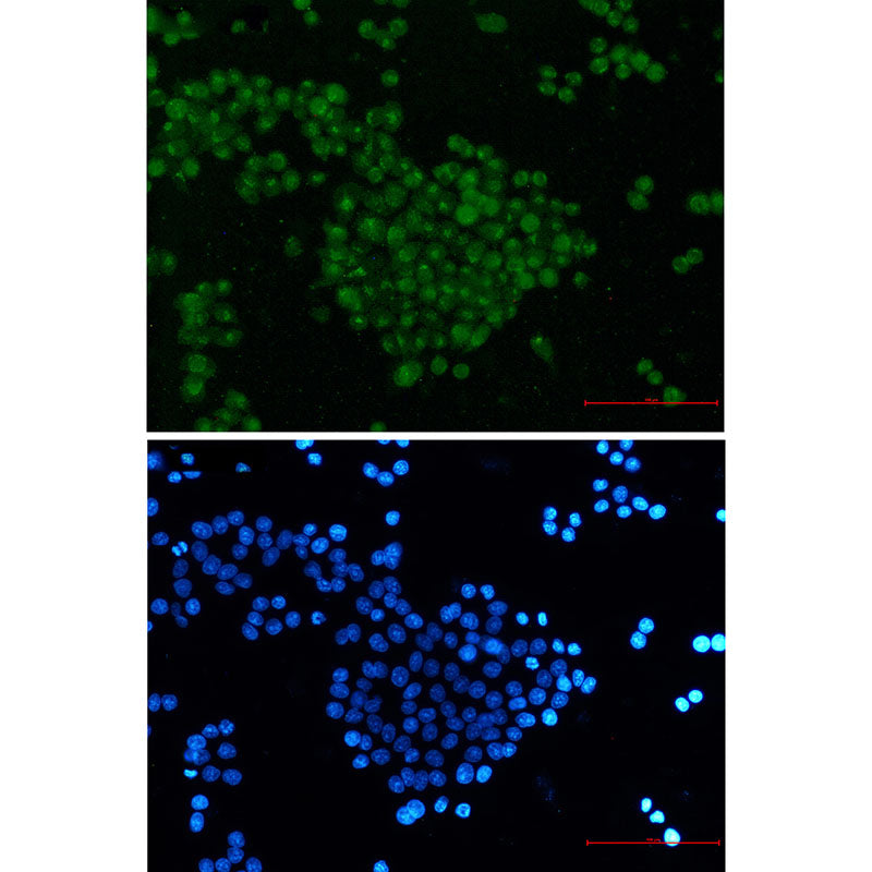 SKP2 Rabbit Monoclonal Antibody