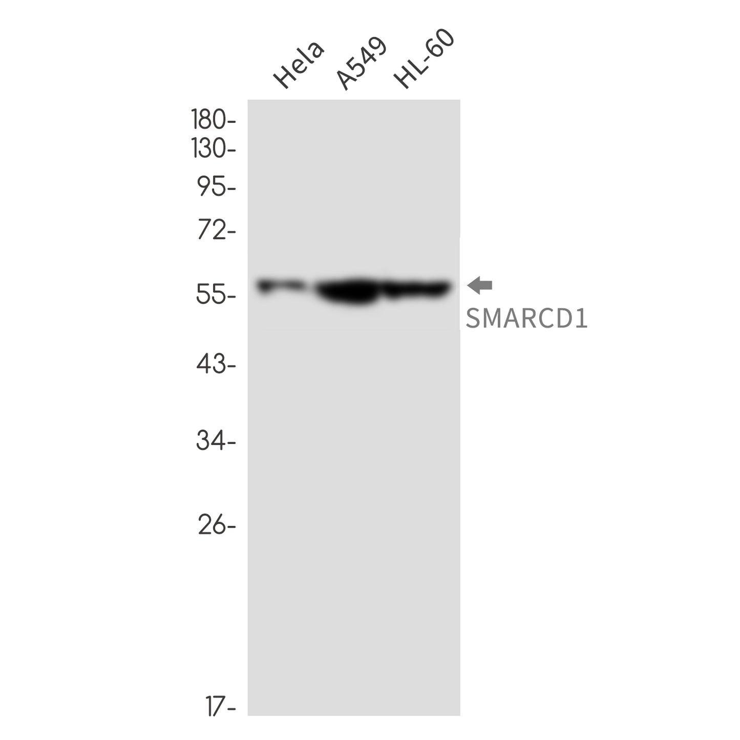 SMARCD1 Rabbit Monoclonal Antibody