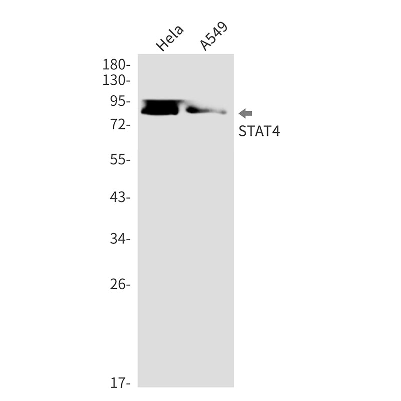 STAT4 Rabbit Monoclonal Antibody