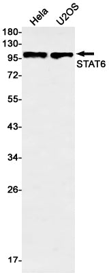 STAT6 Rabbit Monoclonal Antibody