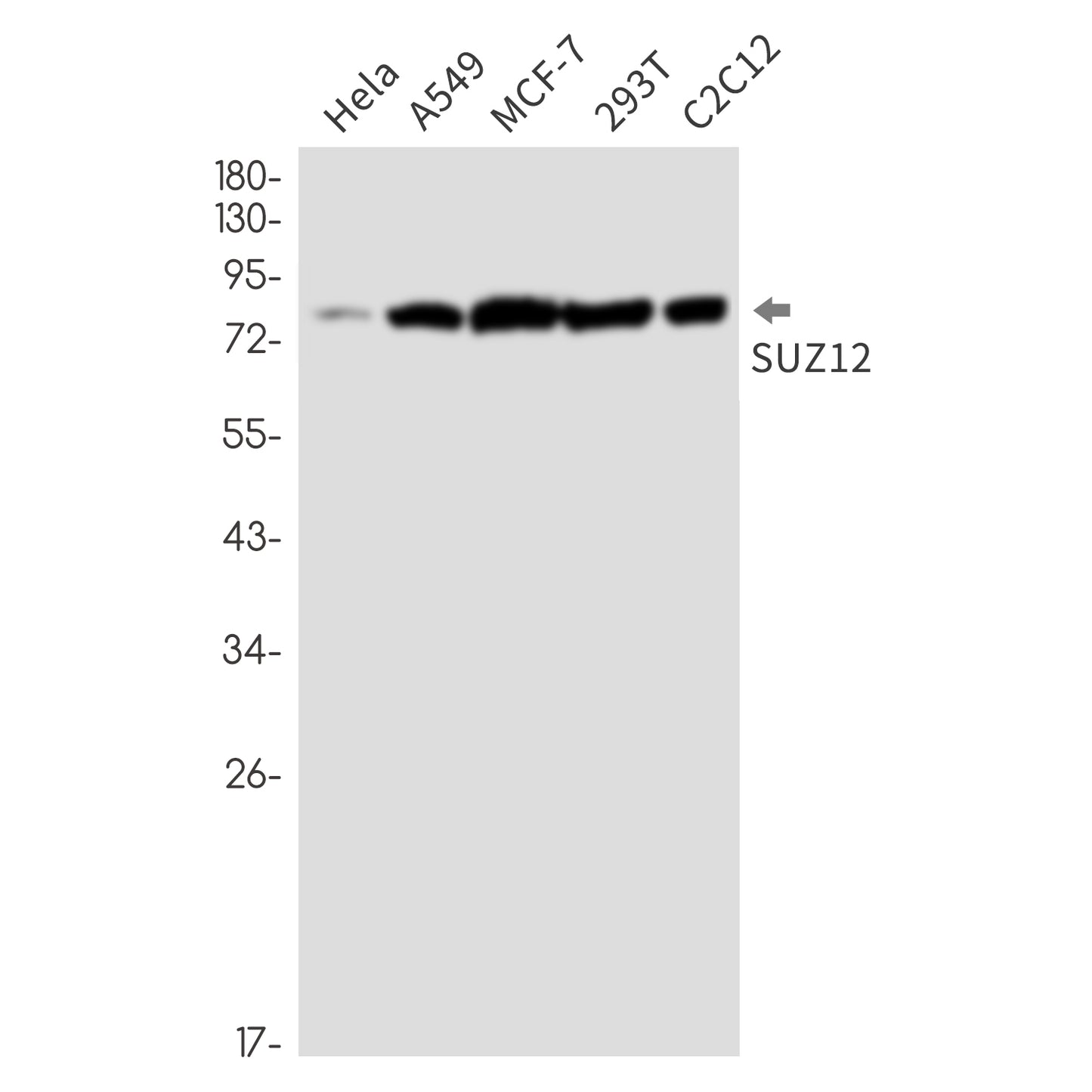 Polycomb Protein SUZ12 Rabbit Monoclonal Antibody