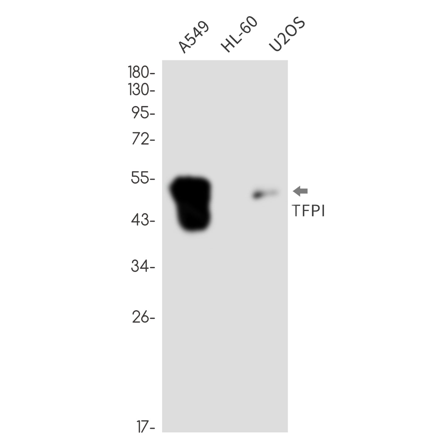 Tissue Factor Pathway Inhibitor Rabbit Monoclonal Antibody