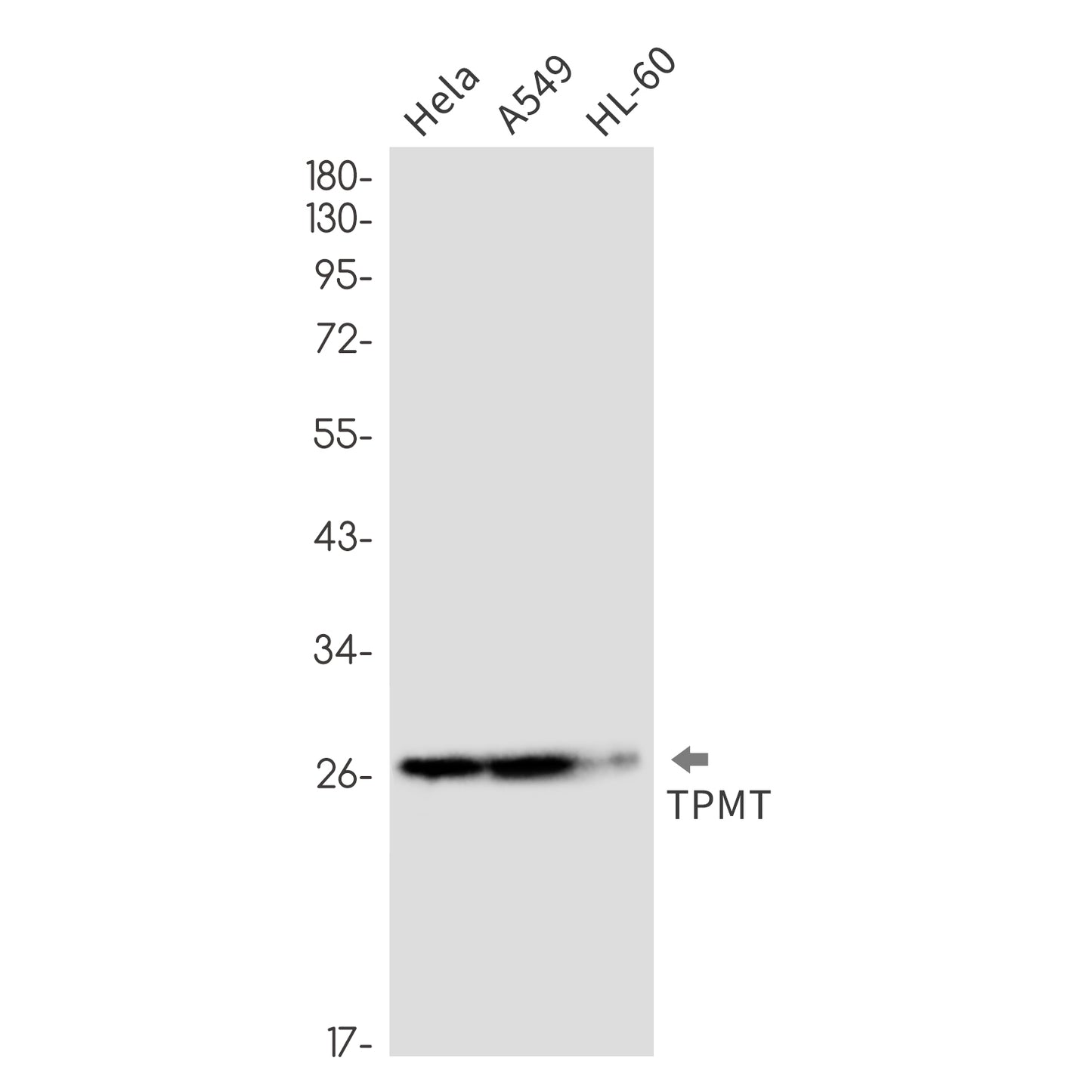 TPMT Rabbit Monoclonal Antibody