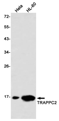 TRAPPC2 Rabbit Monoclonal Antibody
