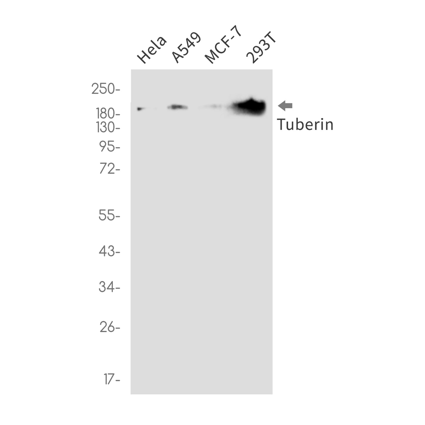 Tuberin Rabbit Monoclonal Antibody