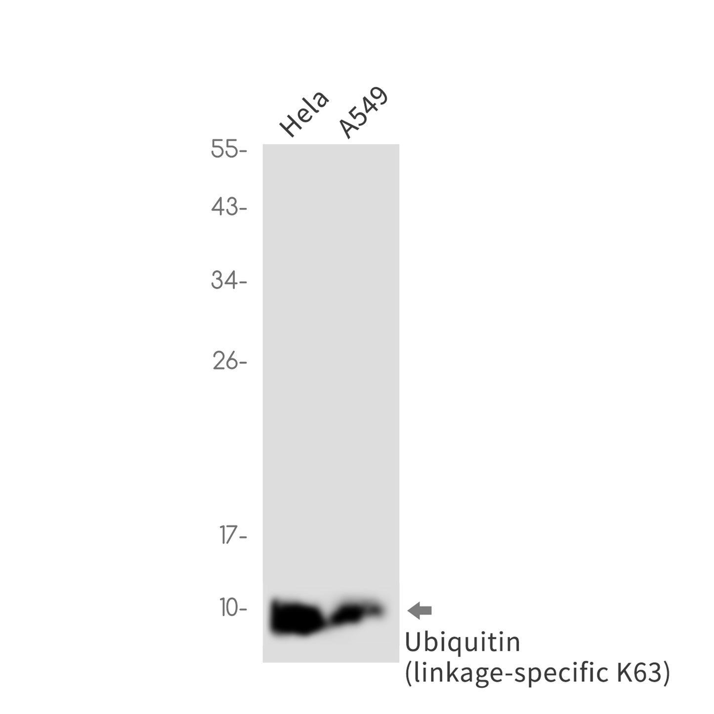 Ubiquitin K63 Rabbit Monoclonal Antibody