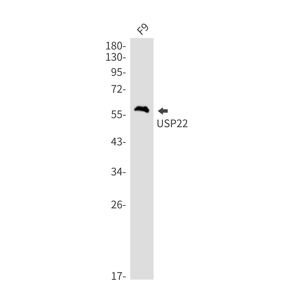 USP22 Rabbit Monoclonal Antibody