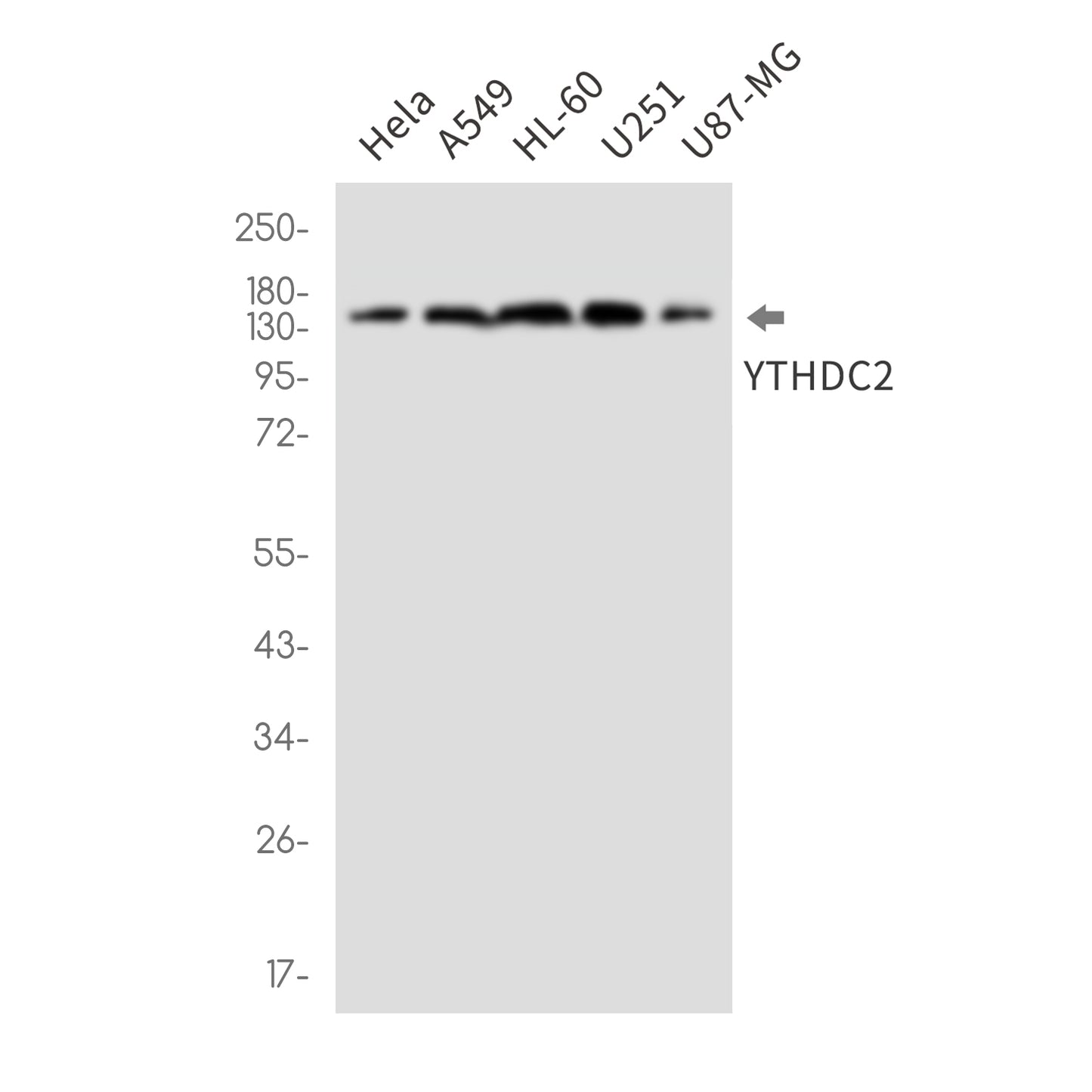YTHDC2 Rabbit Monoclonal Antibody
