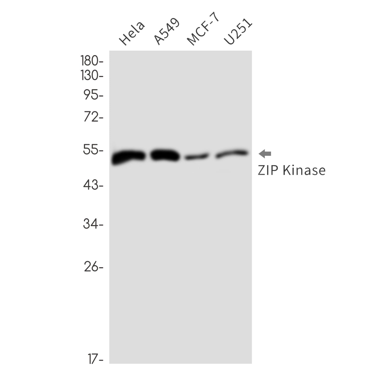 DAP kinase 3 Rabbit Monoclonal Antibody