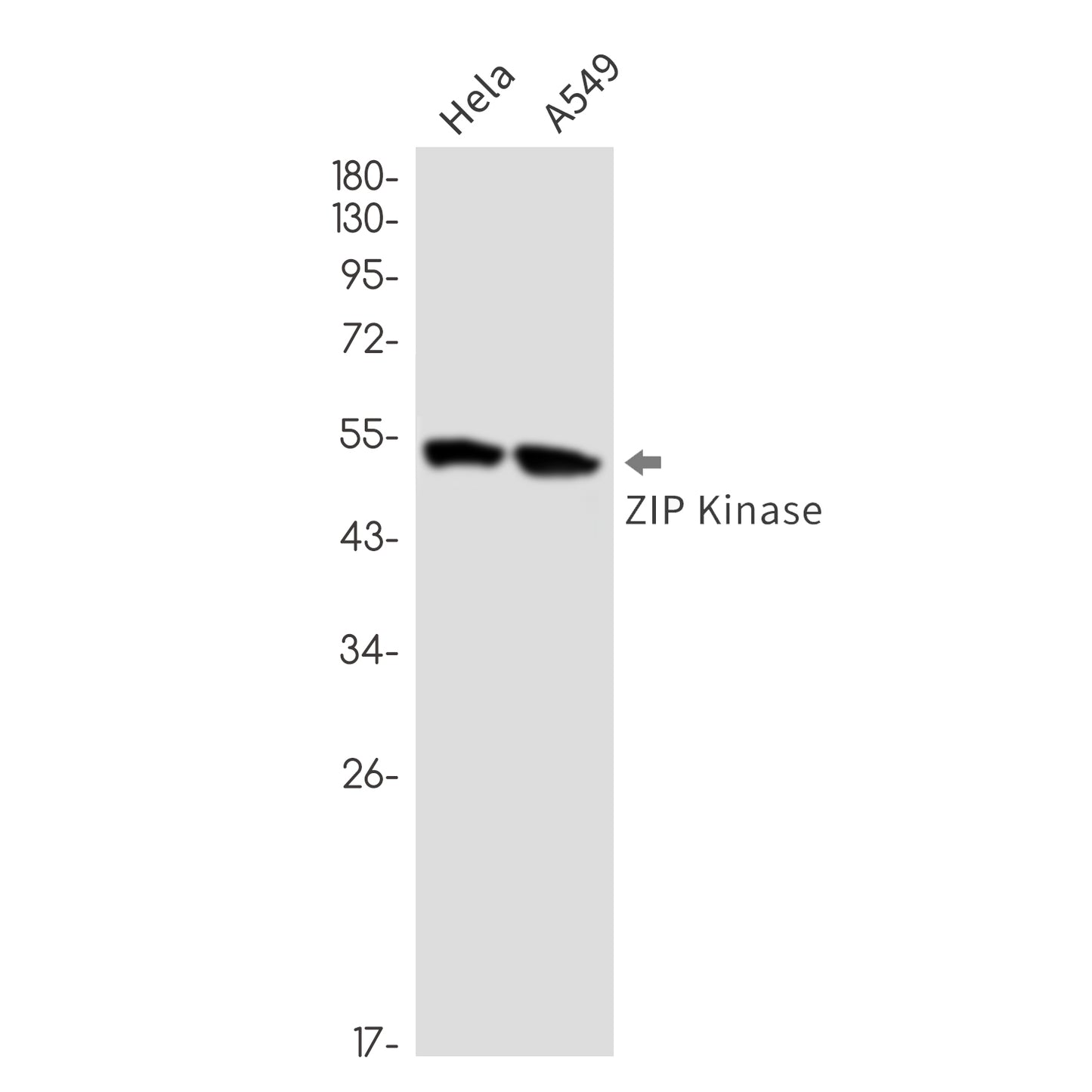 DAP kinase 3 Rabbit Monoclonal Antibody