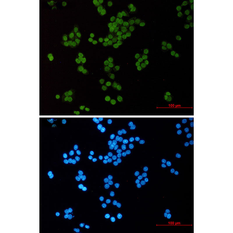 Acetyl-Histone H3 (Lys14) Rabbit Monoclonal Antibody