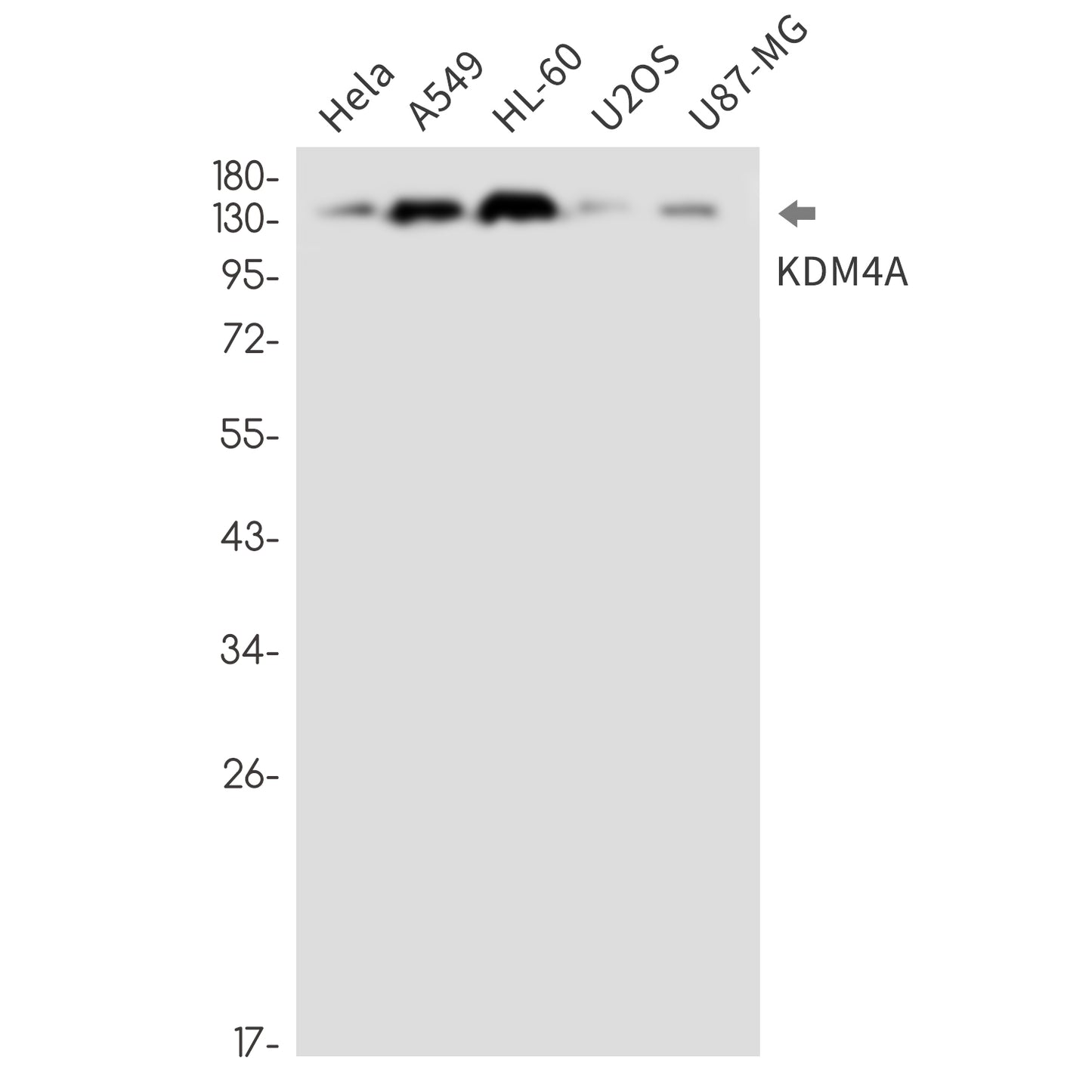 KDM4A Rabbit Monoclonal Antibody