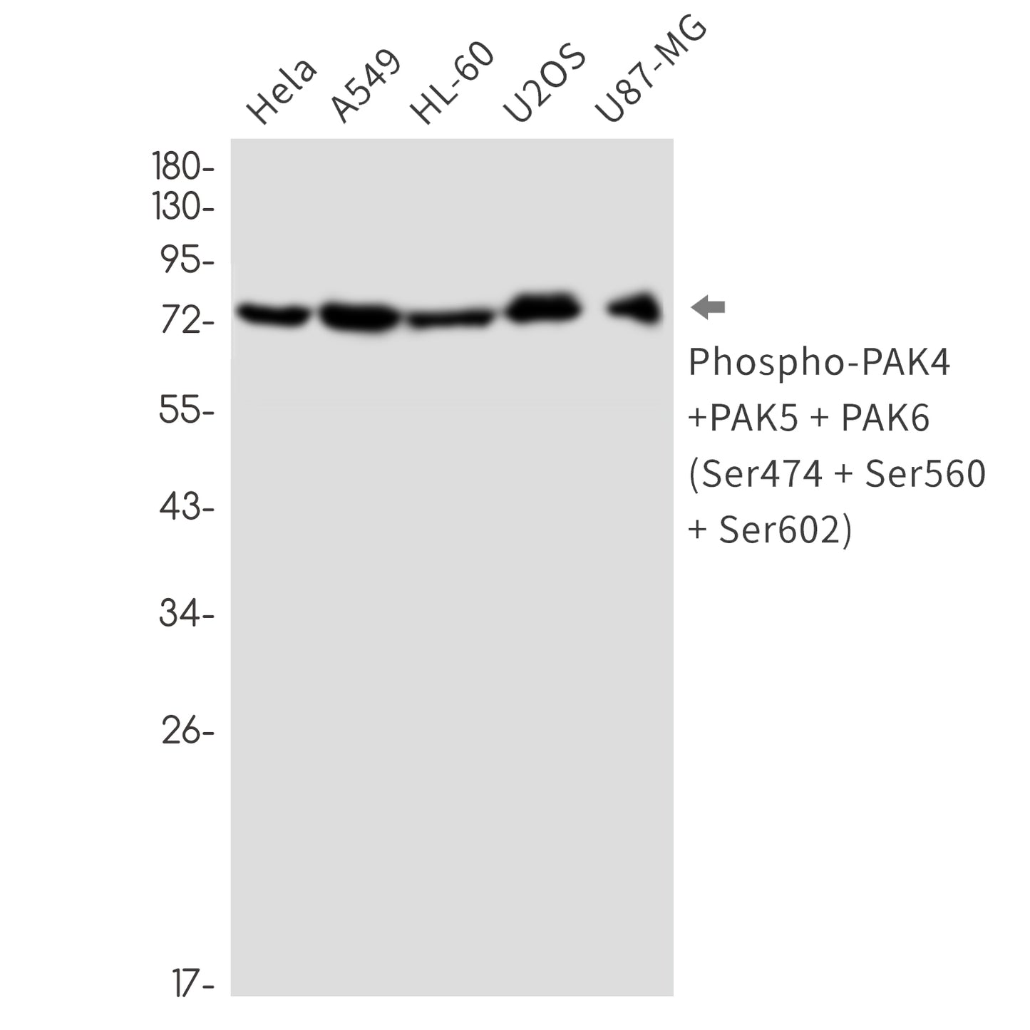 Phospho-PAK4/5/6 (Ser474/Ser560/Ser602) Rabbit Monoclonal Antibody