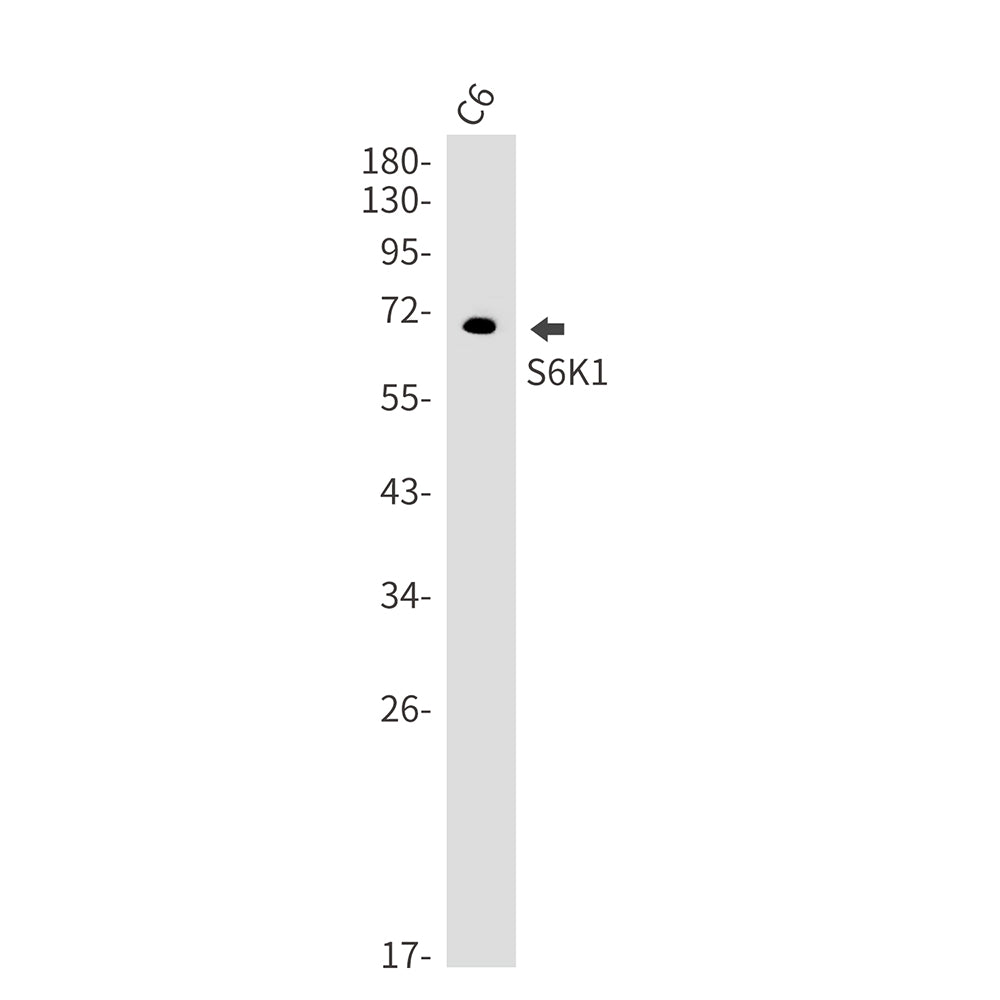 S6K1 Rabbit Monoclonal Antibody