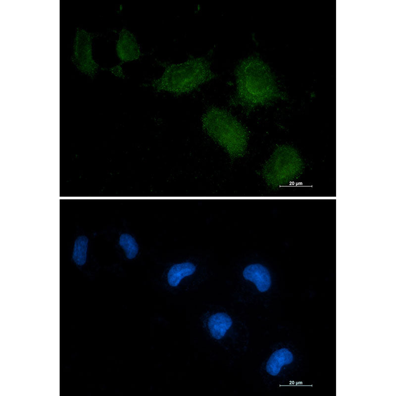 Vitamin D Binding Protein Rabbit Monoclonal Antibody
