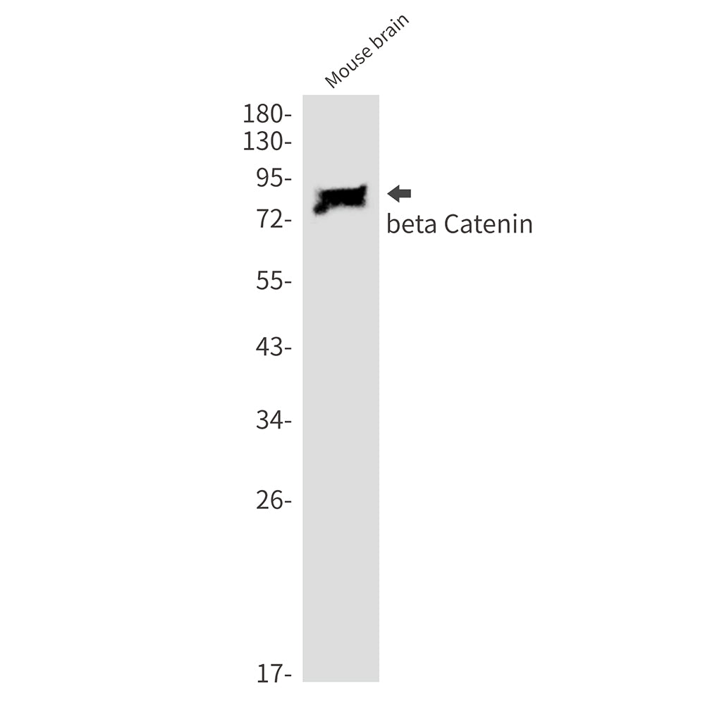 beta Catenin Rabbit Monoclonal Antibody