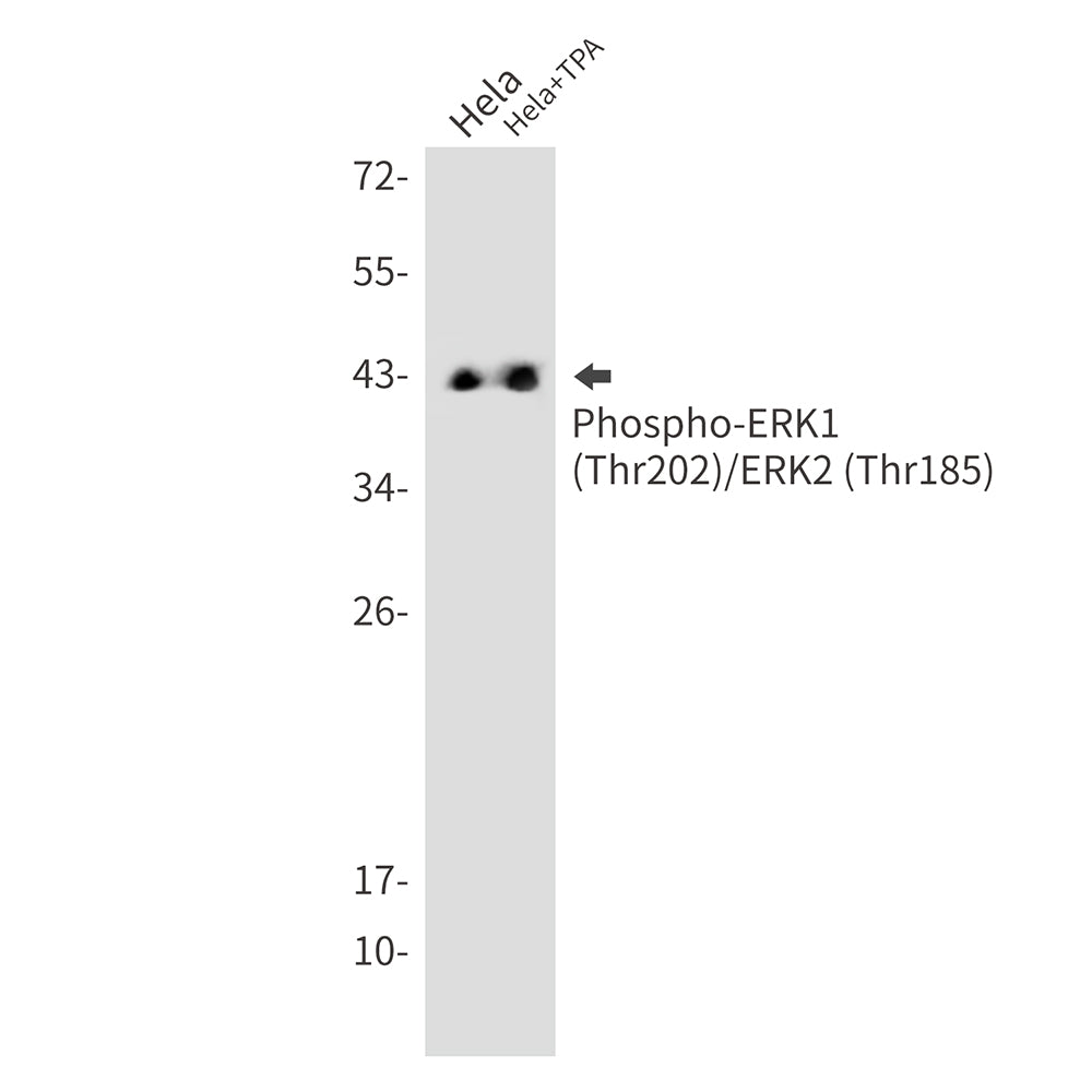 Phospho-ERK1/2 (Thr202/Thr185) Rabbit Monoclonal Antibody