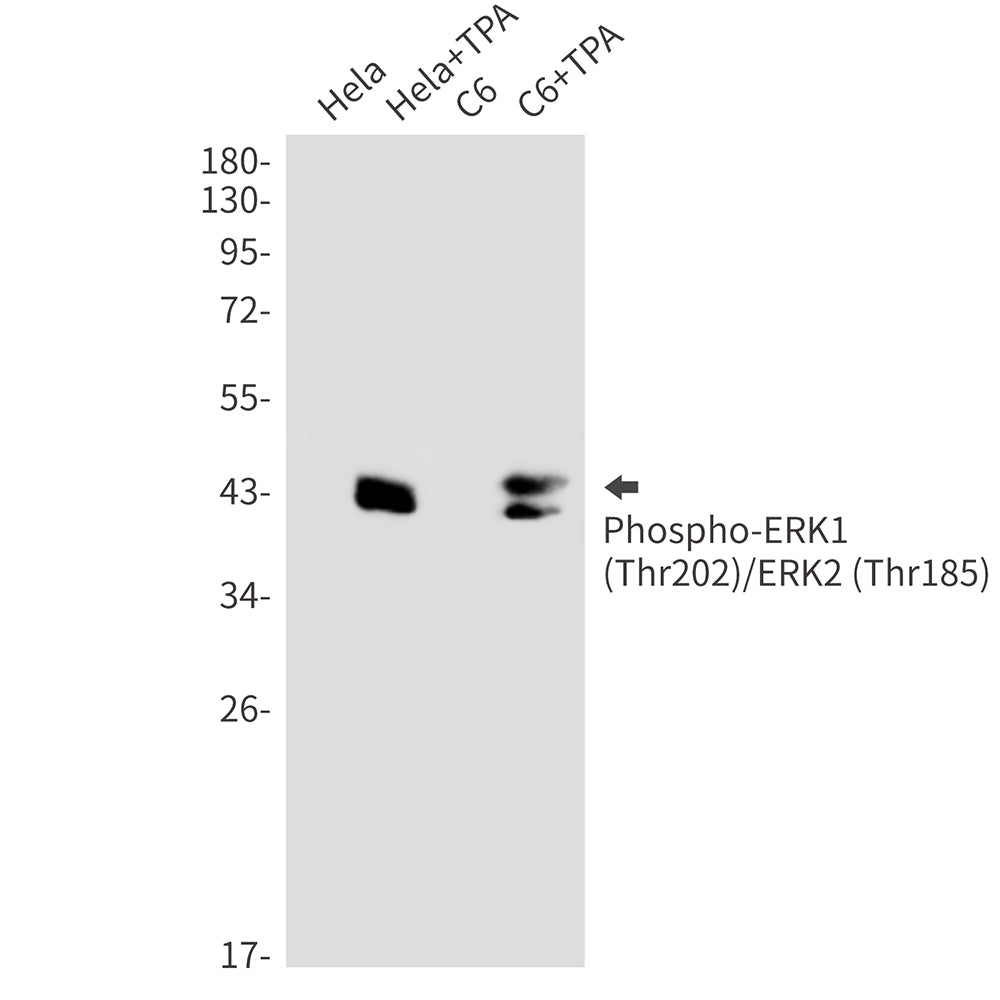 Phospho-ERK1/2 (Thr202/Thr185) Rabbit Monoclonal Antibody
