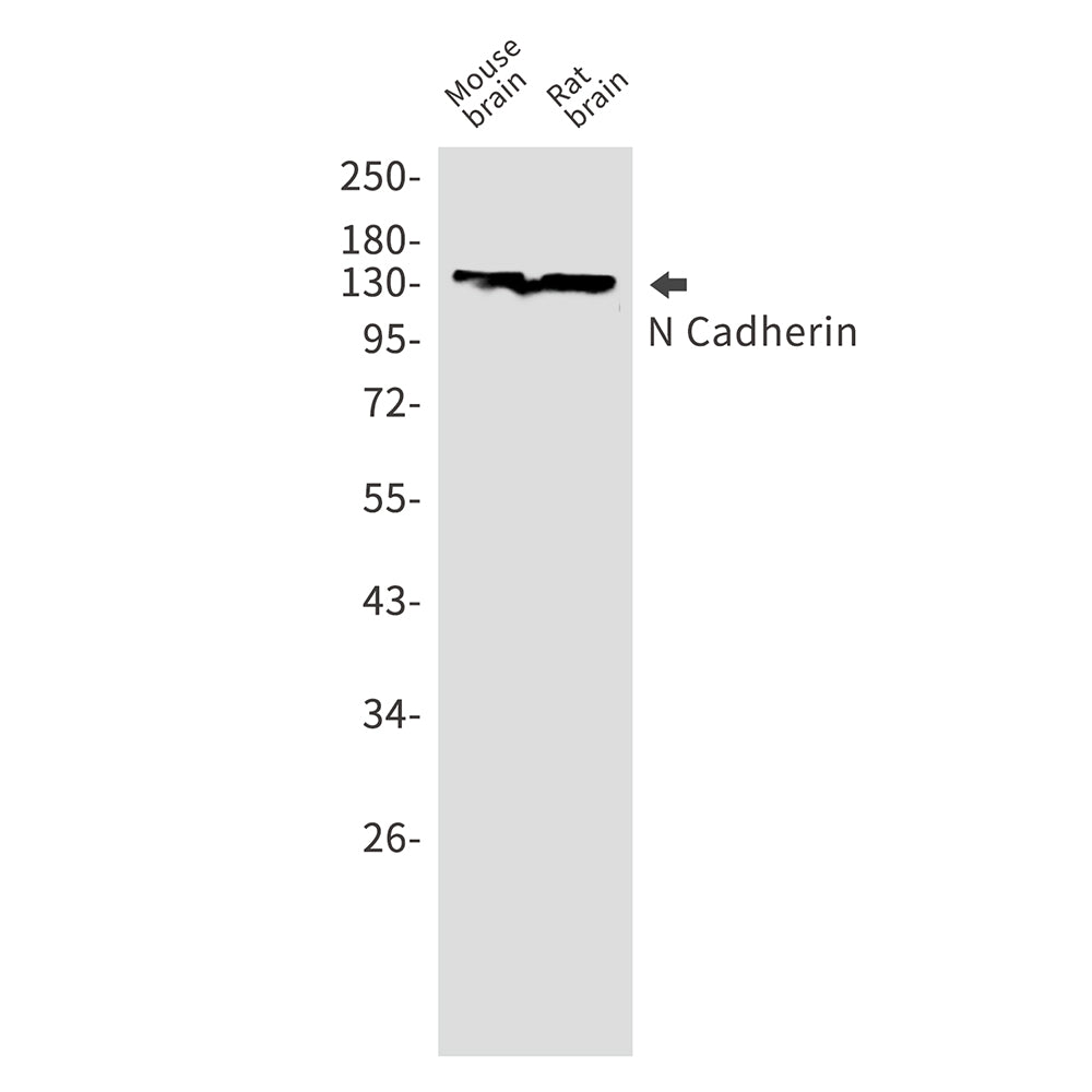 N Cadherin Rabbit Monoclonal Antibody