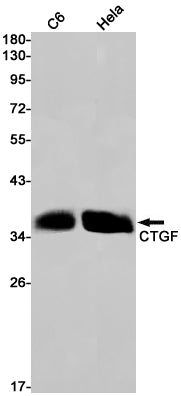 CTGF Rabbit Monoclonal Antibody