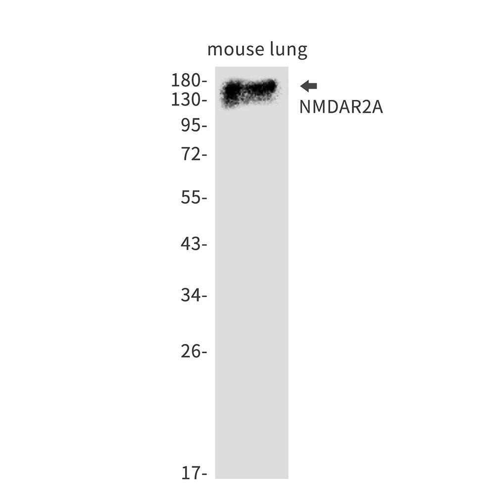 NMDAR2A Rabbit Monoclonal Antibody