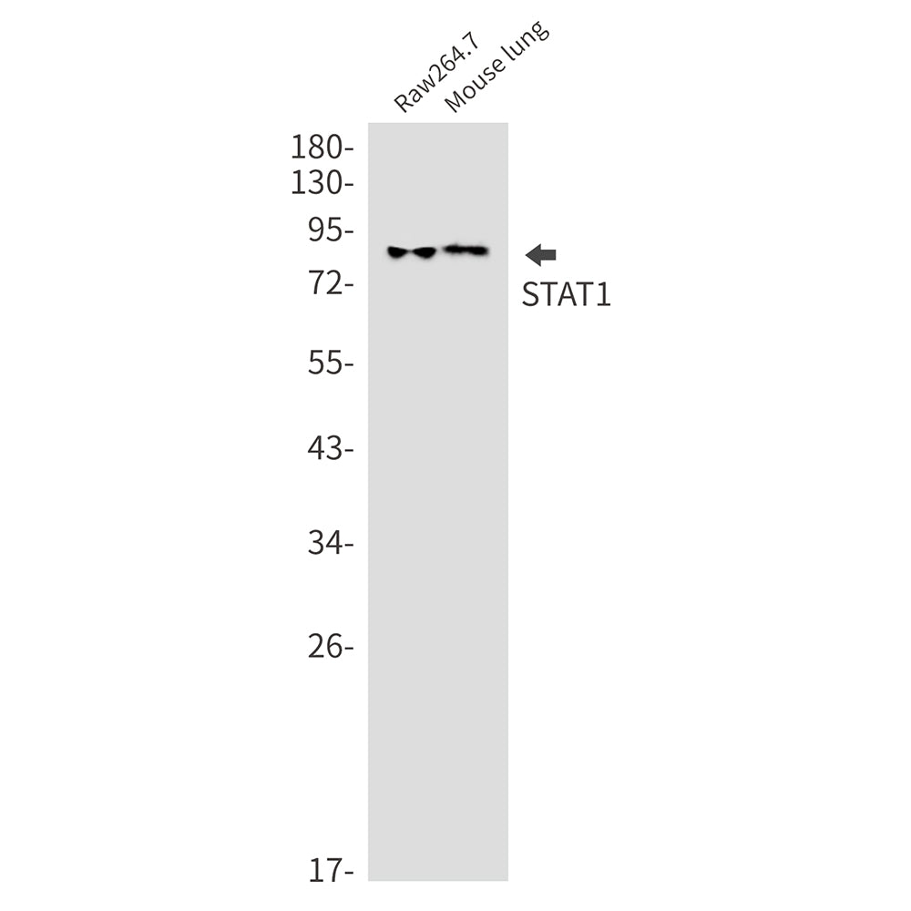 STAT1 Rabbit Monoclonal Antibody
