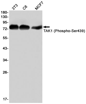 Phospho-TAK1 (Ser439) Rabbit Monoclonal Antibody
