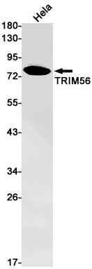 TRIM56 Rabbit Monoclonal Antibody