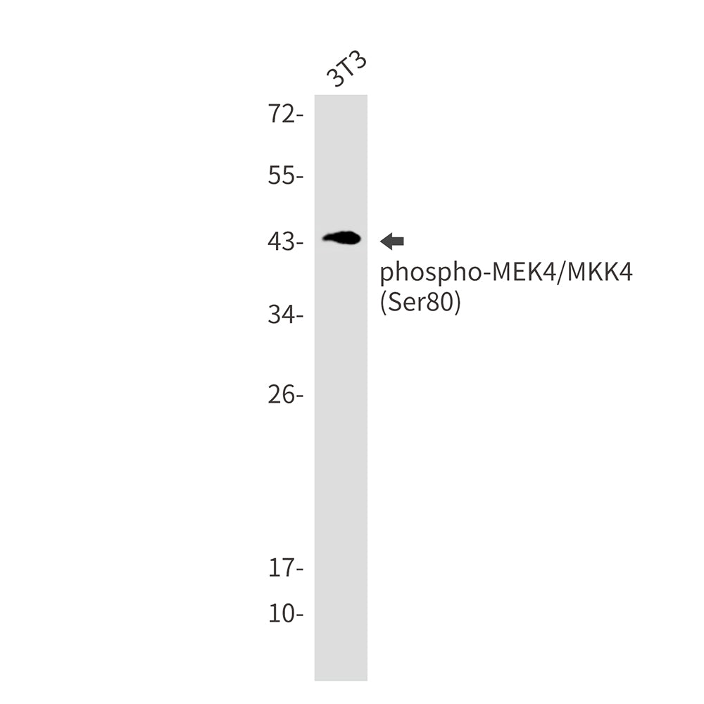 Phospho-MEK4 (Ser80) Rabbit Monoclonal Antibody