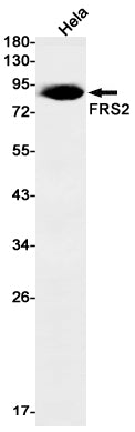 FRS2 Rabbit Monoclonal Antibody