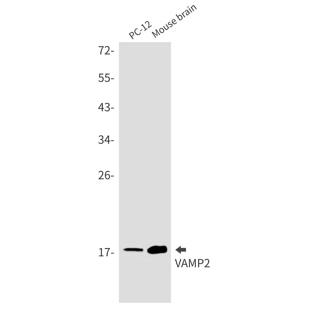 VAMP2 Rabbit Monoclonal Antibody