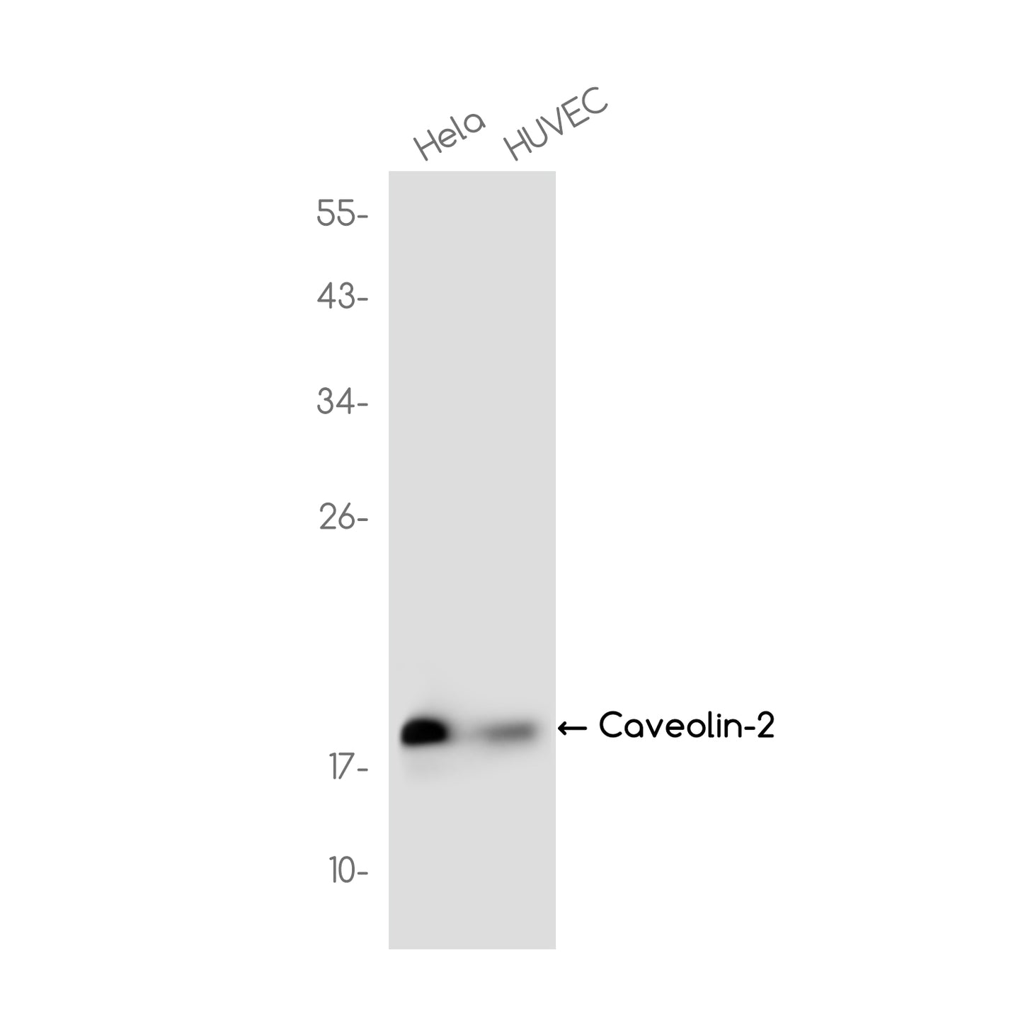 Caveolin 2 Rabbit Monoclonal Antibody