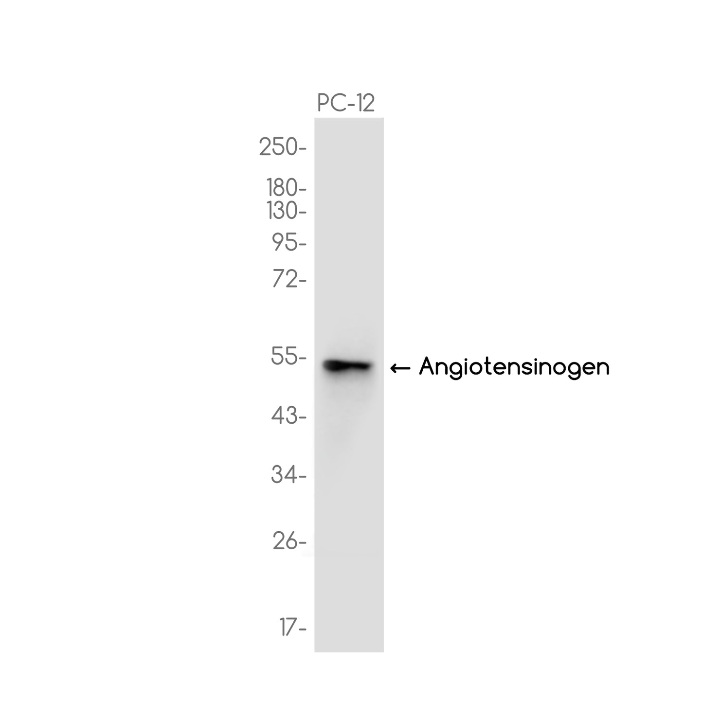 Angiotensinogen Rabbit Monoclonal Antibody