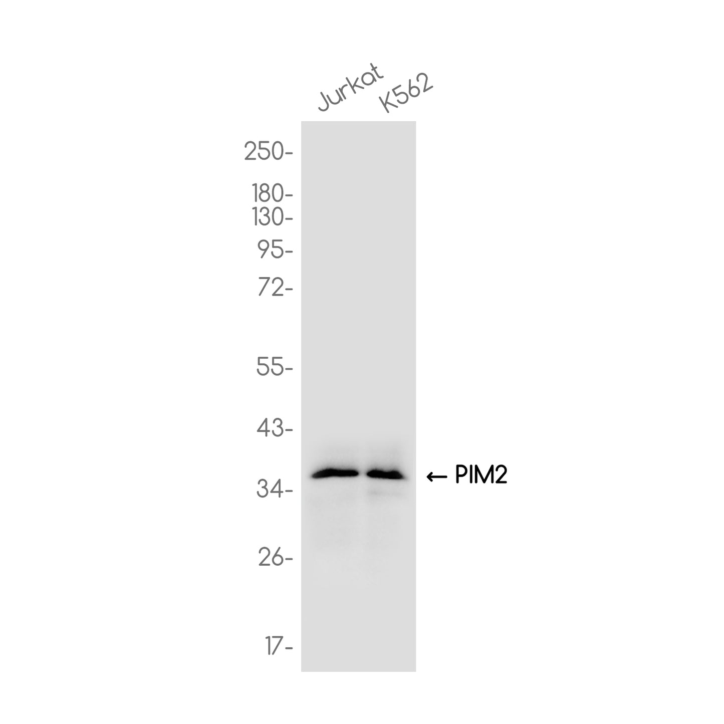 PIM2 Rabbit Monoclonal Antibody
