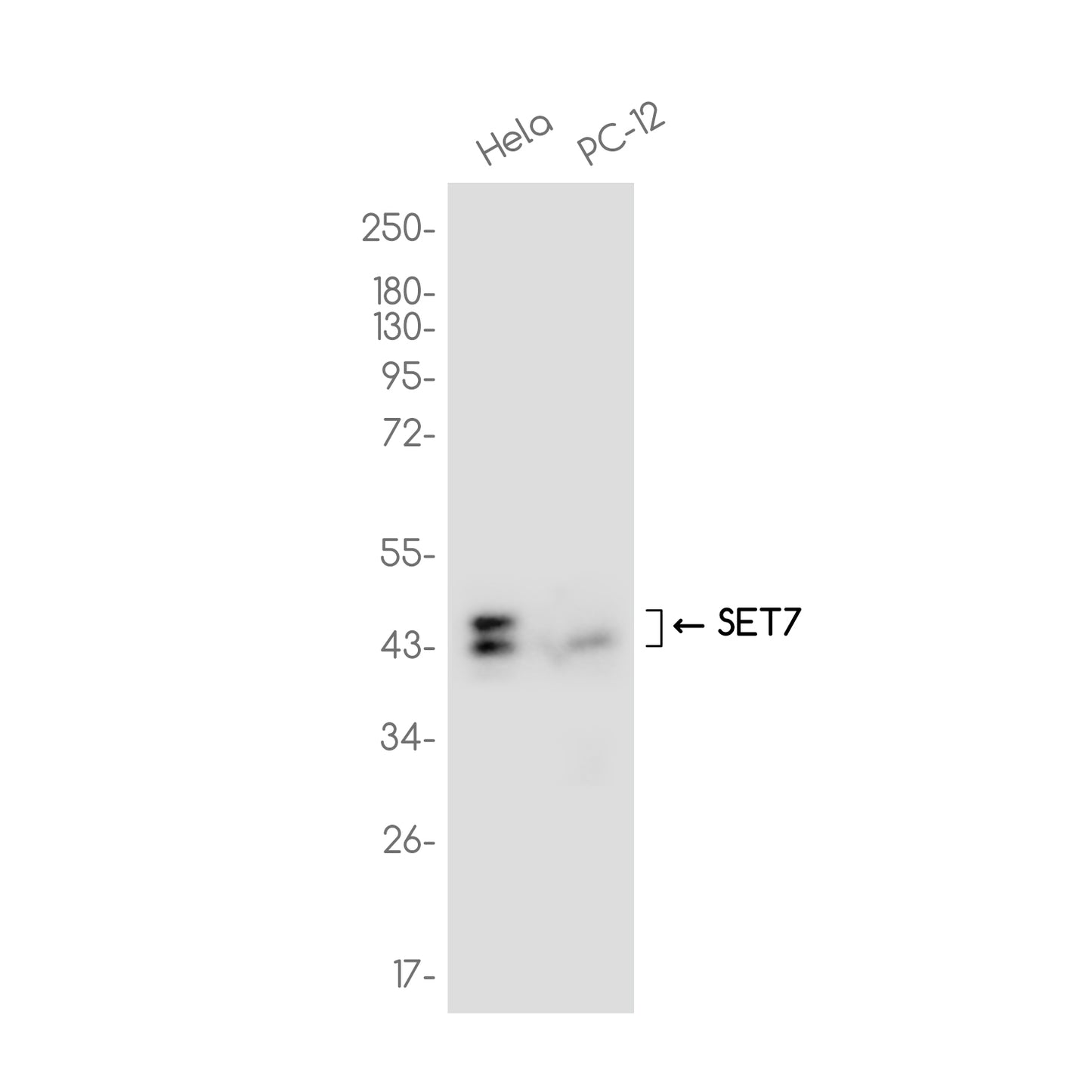 SETD7 Rabbit Monoclonal Antibody