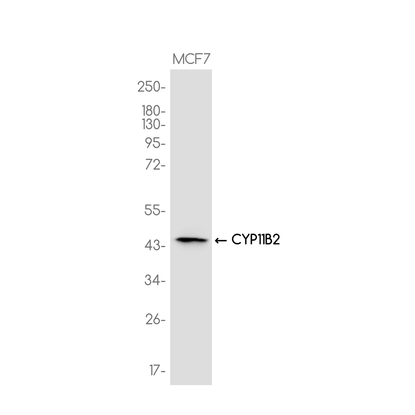 CYP11B2 Rabbit Monoclonal Antibody