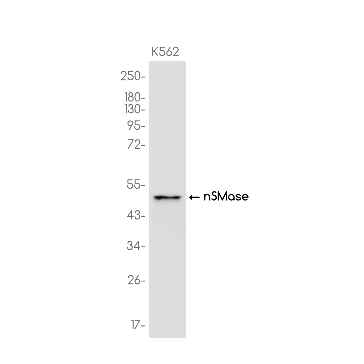 NSMase Rabbit Monoclonal Antibody