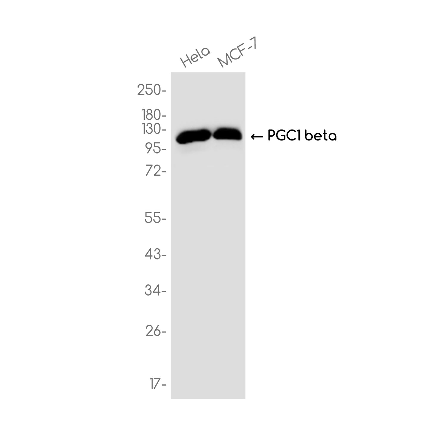 PGC1 beta Rabbit Monoclonal Antibody