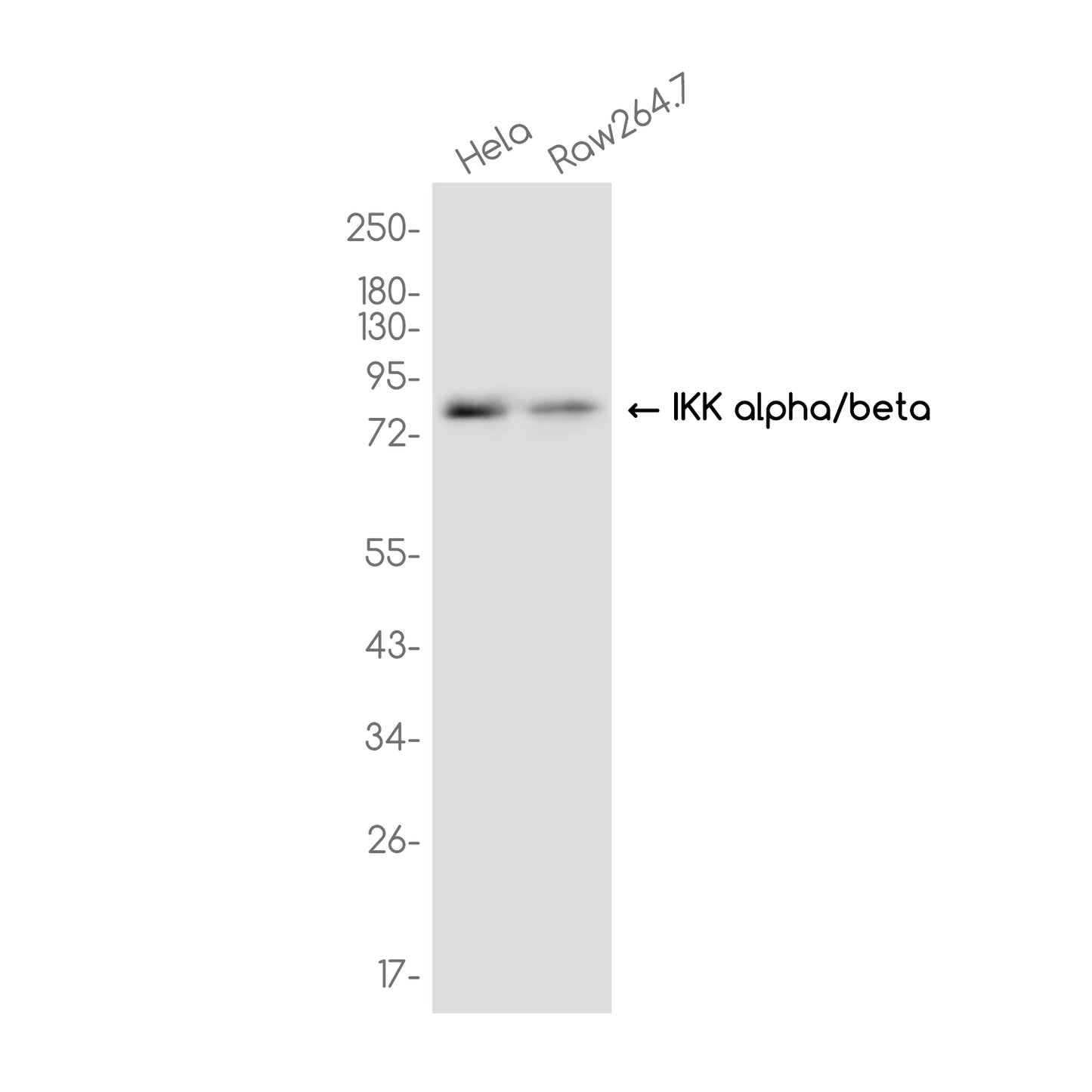 IKK alpha/beta Rabbit Monoclonal Antibody