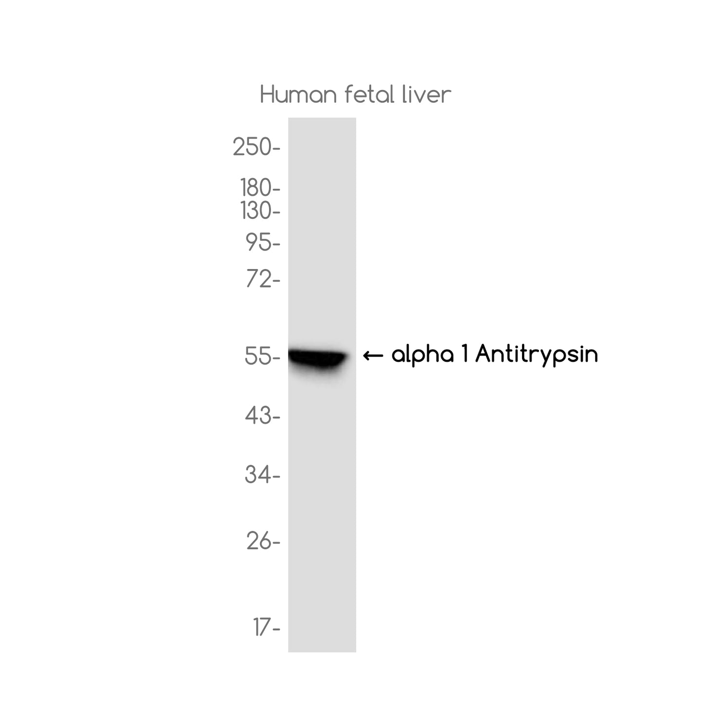 alpha 1-Antitrypsin Rabbit Monoclonal Antibody